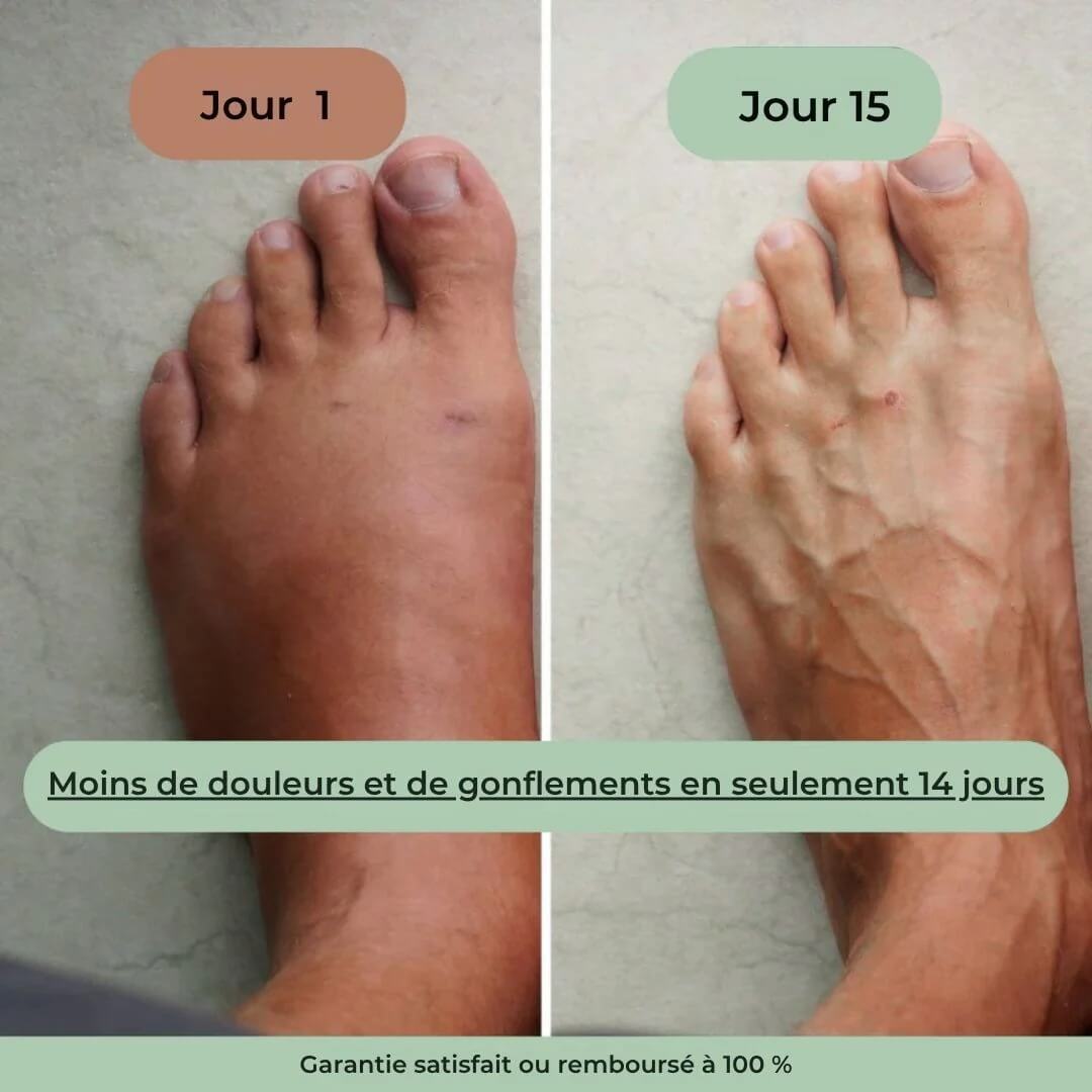 ThermoMasseur - Dites enfin adieu aux douleur et à vos problèmes neuropathiques (Satisfait ou Remboursé)(GB)
