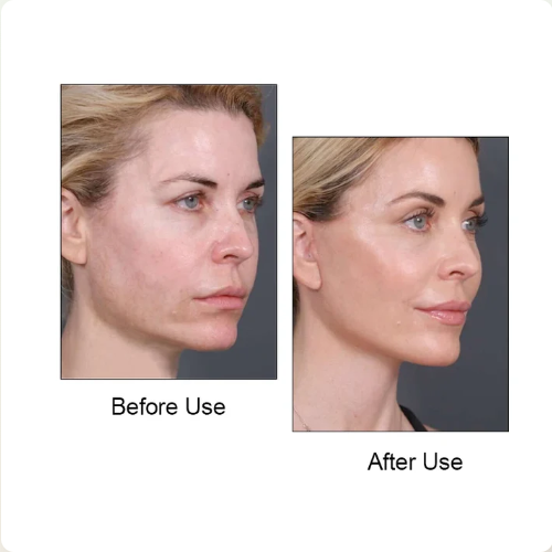 Bandage Amincissant Visage !