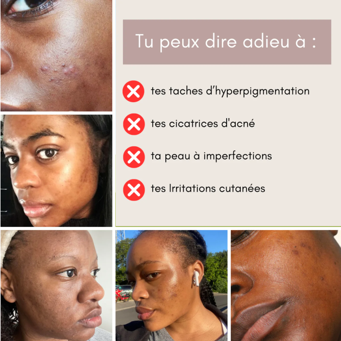 MOIKA™ ORIGINAL – Cotons au Curcuma & Acide Kojique (50 Cotons)