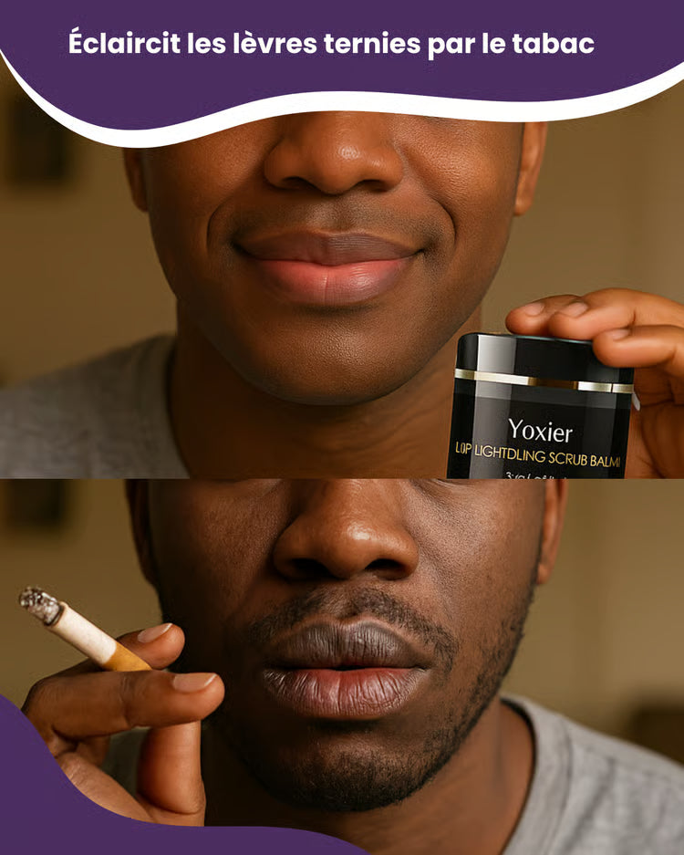 Yoxier™ | Sérum éclaircissant pour lèvres foncée ou ternies par le tabac-Satisfait ou remboursé (Côte d'Ivoire)
