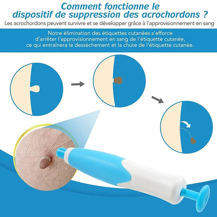 Kit DermaSkin Pro™ – Adieu Les Acrochordons, Résultat Immédiat BF