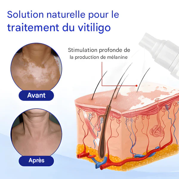 ÉCLAT NATUREL – SPRAY CORRECTEUR DE TEINT 🌟-BF