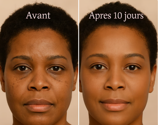 Crème Coréenne Contour des Yeux Seoul 1988 BN