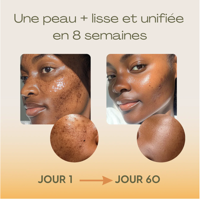 MOIKA™ ORIGINAL – Cotons au Curcuma & Acide Kojique (50 Cotons)